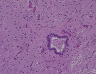 Microscope image of spinal cord showing various cell types and what was likely the central canal.