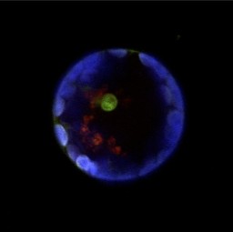 WALK in green being synthesized inside a cell