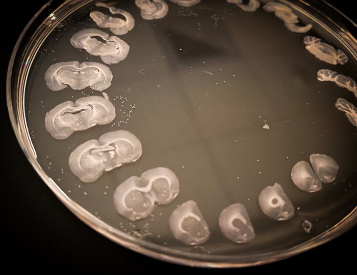 Anatomically organized rat brain sections ready to be put onto microscope slides for analysis