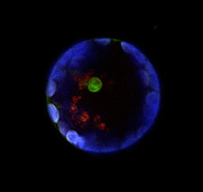 Leaf Cells Image